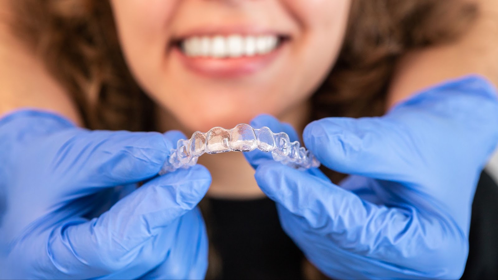 Are Clear Aligners Worth the Investment? 
